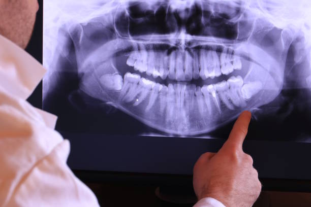 Best Emergency Broken Tooth Repair in Steilacoom, WA